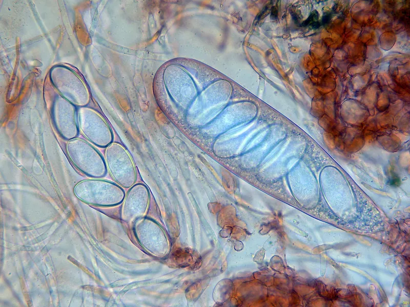 Ascobolus immersus 10 - Ascos x 400-001
